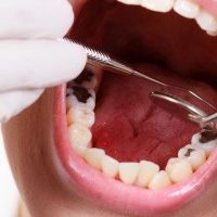 18436282_l-dental-treatment-300x200